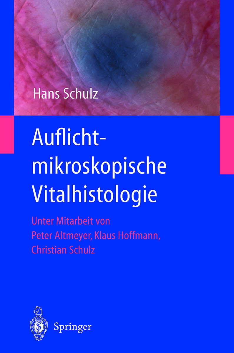 Auflichtmikroskopische Vitalhistologie